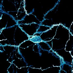 Una neurona densamente cubierta de espinas dendríticas del cuerpo estriado de un cerebro de ratón adulto